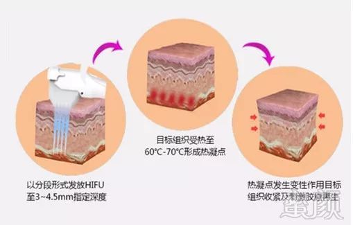 案例图片