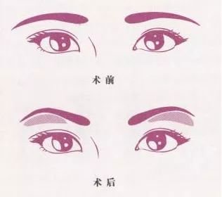 https://img.miyanlife.com/mnt/timg/180124/121A32548-9.jpg