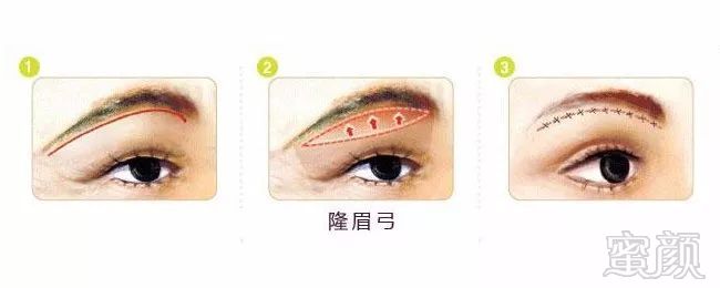 https://img.miyanlife.com/mnt/timg/180124/121A44612-10.jpg