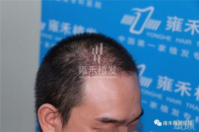 https://img.miyanlife.com/mnt/timg/180124/123104O32-3.jpg