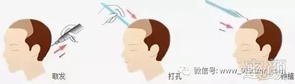 https://img.miyanlife.com/mnt/timg/180124/13015961P-15.jpg