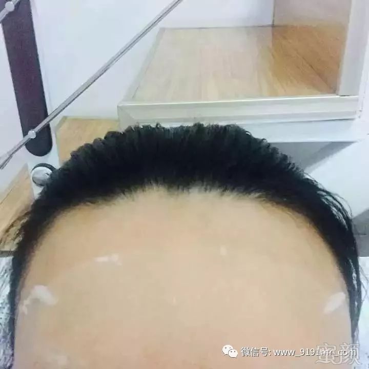 https://img.miyanlife.com/mnt/timg/180124/13015SP0-10.jpg