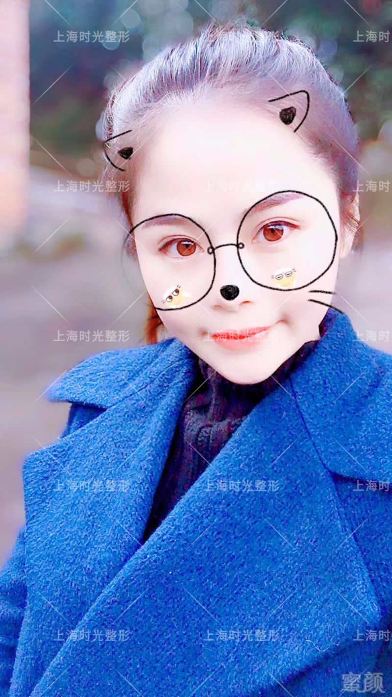 https://img.miyanlife.com/mnt/timg/180124/13262322A-3.jpg