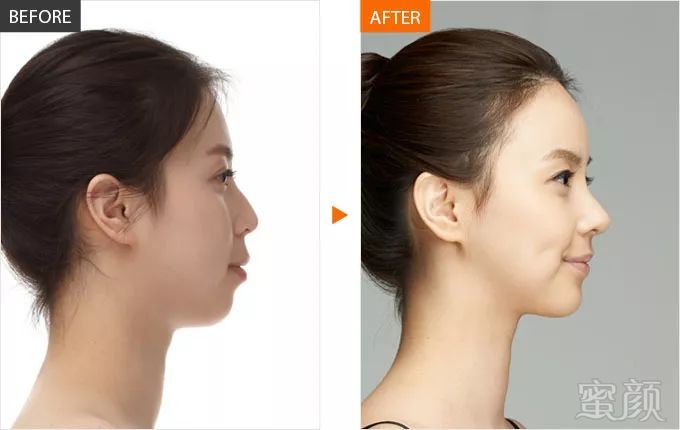 https://img.miyanlife.com/mnt/timg/180125/1155223091-6.jpg