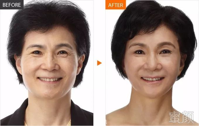 https://img.miyanlife.com/mnt/timg/180125/1155234347-10.jpg