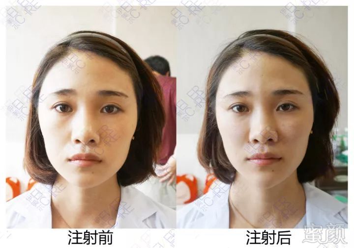 https://img.miyanlife.com/mnt/timg/180125/12044I937-5.jpg