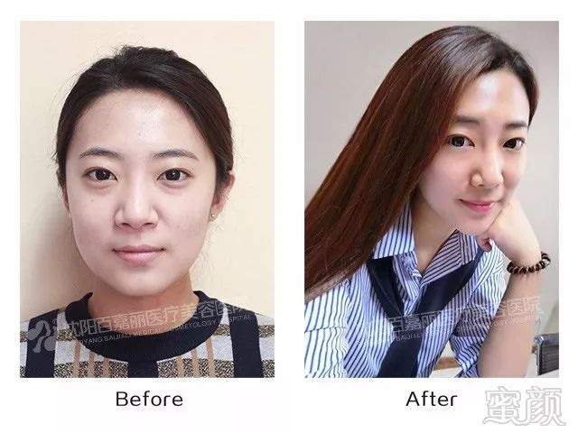 https://img.miyanlife.com/mnt/timg/180125/120H31512-3.jpg