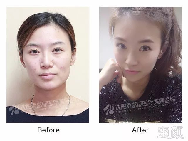 https://img.miyanlife.com/mnt/timg/180125/120HV603-5.jpg