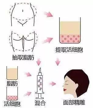 https://img.miyanlife.com/mnt/timg/180125/125930A45-9.jpg