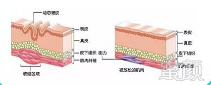 案例图片