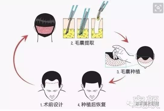https://img.miyanlife.com/mnt/timg/180125/13210H059-1.jpg