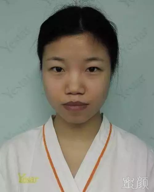 https://img.miyanlife.com/mnt/timg/180125/1321134E4-5.jpg
