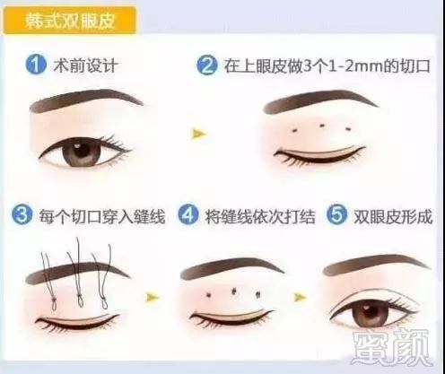 https://img.miyanlife.com/mnt/timg/180125/1355011S2-13.jpg