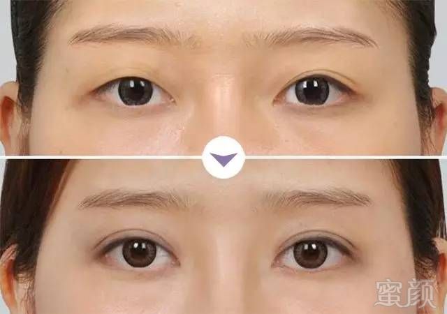 https://img.miyanlife.com/mnt/timg/180126/103Q26004-3.jpg