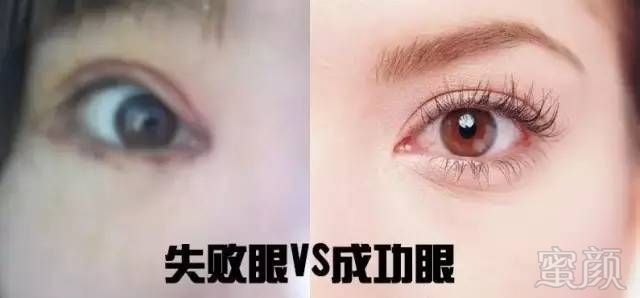 https://img.miyanlife.com/mnt/timg/180126/103Q2OI-1.jpg