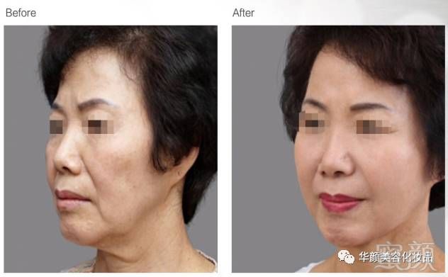 https://img.miyanlife.com/mnt/timg/180126/104G45355-6.jpg