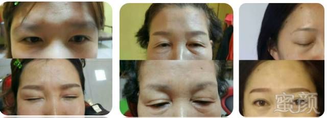 https://img.miyanlife.com/mnt/timg/180126/1050052R7-3.jpg