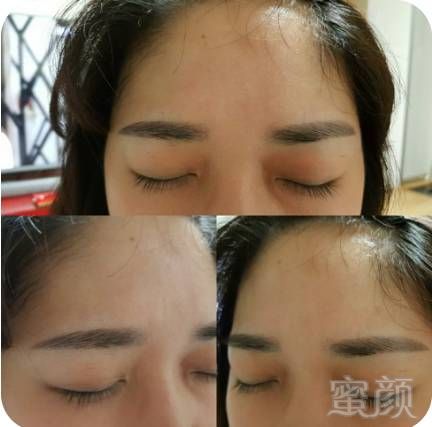 https://img.miyanlife.com/mnt/timg/180126/1050056142-5.jpg