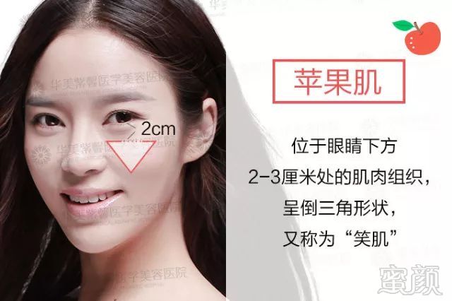 https://img.miyanlife.com/mnt/timg/180126/1054464128-5.jpg