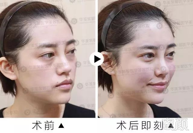 https://img.miyanlife.com/mnt/timg/180126/10545011G-9.jpg