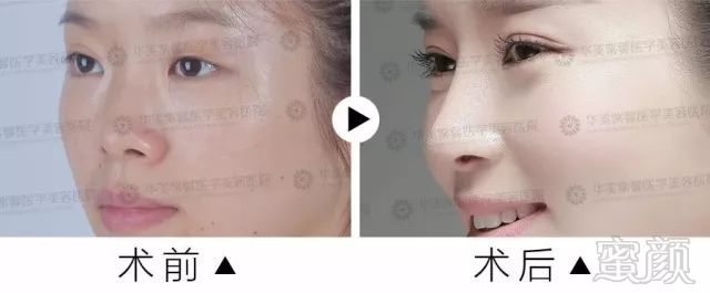 https://img.miyanlife.com/mnt/timg/180126/1054515D0-15.jpg