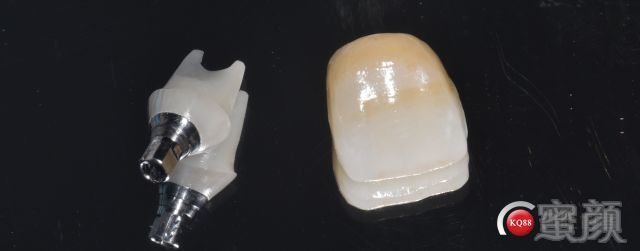 https://img.miyanlife.com/mnt/timg/180126/11103L262-11.jpg