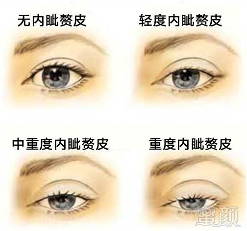 https://img.miyanlife.com/mnt/timg/180126/1206344J0-2.jpg