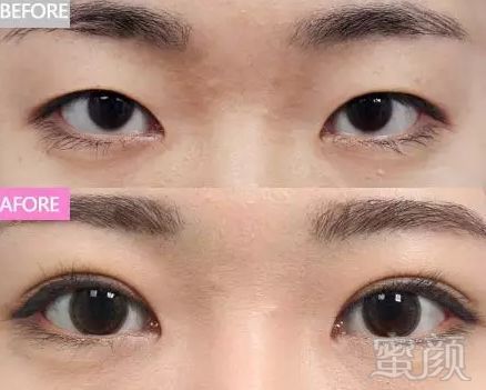 https://img.miyanlife.com/mnt/timg/180126/12063LU9-7.jpg