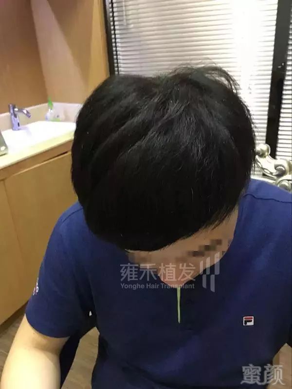 https://img.miyanlife.com/mnt/timg/180126/120K910c-9.jpg