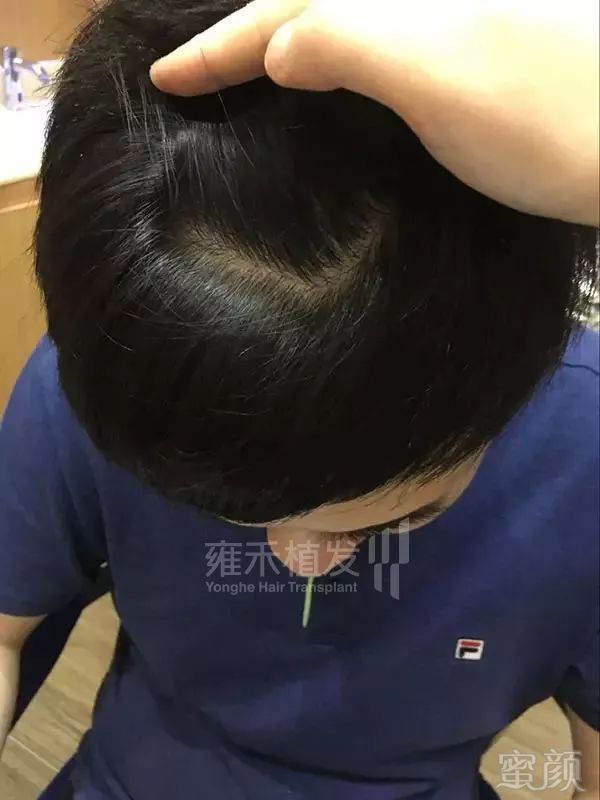 https://img.miyanlife.com/mnt/timg/180126/120K951O-10.jpg