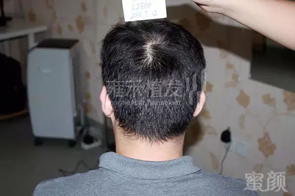 https://img.miyanlife.com/mnt/timg/180126/120KH427-2.jpg