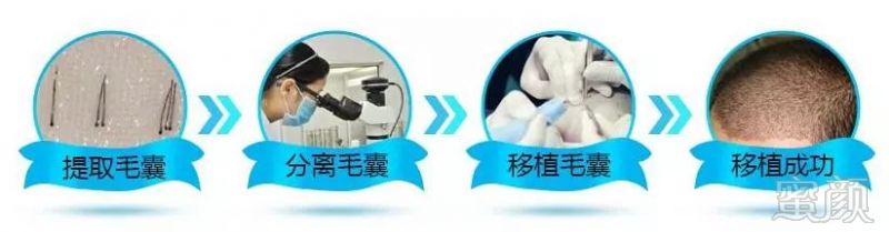 https://img.miyanlife.com/mnt/timg/180126/1215461P8-1.jpg