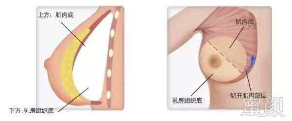 https://img.miyanlife.com/mnt/timg/180126/1255324515-5.jpg