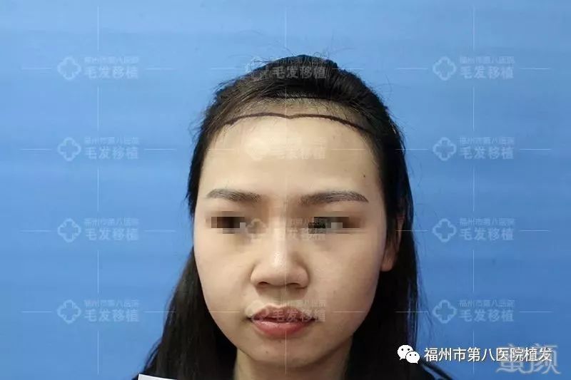 https://img.miyanlife.com/mnt/timg/180126/1324022512-1.jpg