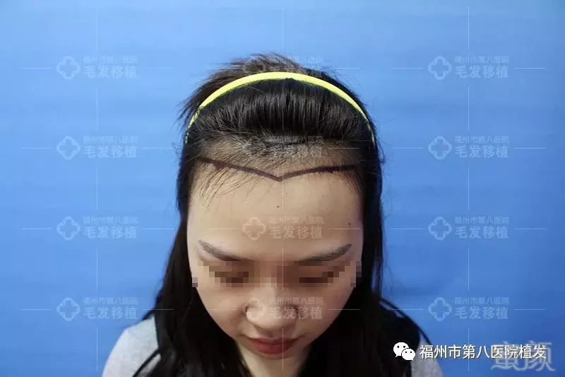 https://img.miyanlife.com/mnt/timg/180126/1324022H4-0.jpg