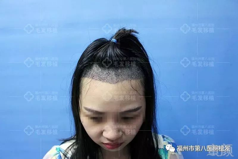 https://img.miyanlife.com/mnt/timg/180126/1324036028-3.jpg