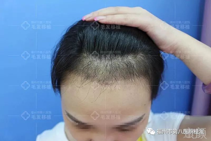 https://img.miyanlife.com/mnt/timg/180126/13240431W-5.jpg