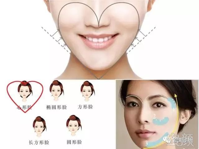 https://img.miyanlife.com/mnt/timg/180126/1340321558-6.jpg