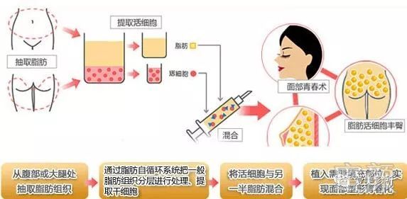https://img.miyanlife.com/mnt/timg/180126/134032G12-8.jpg
