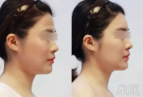 https://img.miyanlife.com/mnt/timg/180126/14125A109-3.jpg