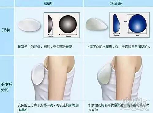 https://img.miyanlife.com/mnt/timg/180127/103J41957-2.jpg