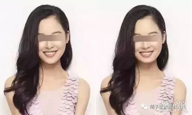 https://img.miyanlife.com/mnt/timg/180127/10422a540-0.jpg