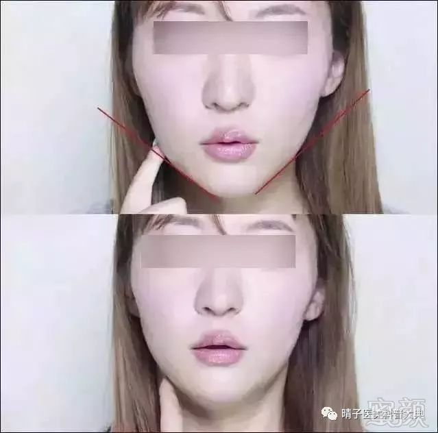 https://img.miyanlife.com/mnt/timg/180127/104231E01-5.jpg