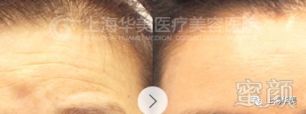 https://img.miyanlife.com/mnt/timg/180127/1045346457-2.jpg