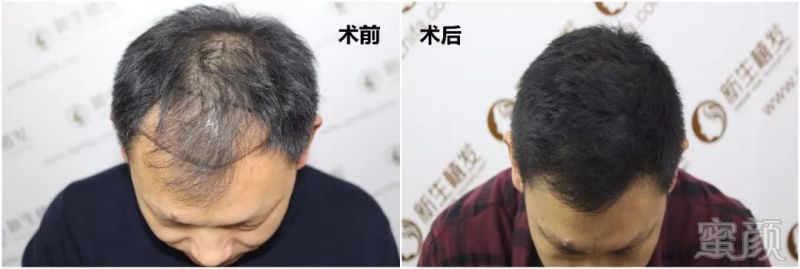 https://img.miyanlife.com/mnt/timg/180127/104A2DO-1.jpg