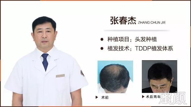 https://img.miyanlife.com/mnt/timg/180127/104A43A3-5.jpg