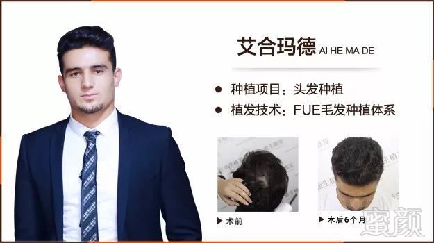 https://img.miyanlife.com/mnt/timg/180127/104A54208-7.jpg