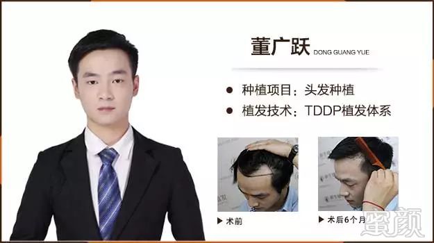 https://img.miyanlife.com/mnt/timg/180127/104A54512-8.jpg