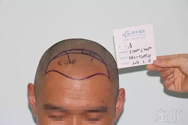 https://img.miyanlife.com/mnt/timg/180127/10595V212-5.jpg