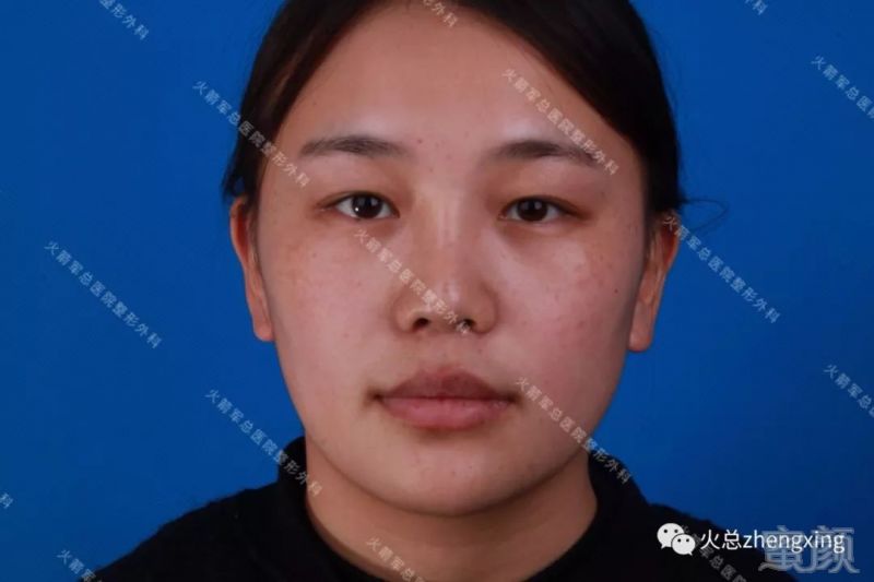 https://img.miyanlife.com/mnt/timg/180127/11011W154-1.jpg
